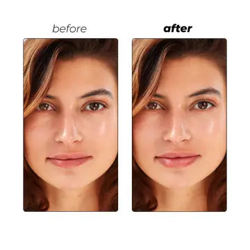 Instant Lip Filler Micro-Dart Patch